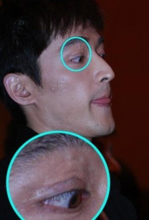 俞灏明selina胡歌 因意外惨遭毁容的十大明星